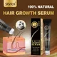 Sevich 20ml Ginger Hair Growth Oil Thickener Essence Anti Hair Loss Care Scalp Massage Roller