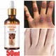 Fast Whitening Dark Knuckles Products Intense Stains Remover Hand Knuckle Elbows Knee Melanin