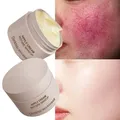 Crème réparatrice des rougeurs du visage améliore la peau sensible la sécheresse hydratant