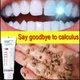 Zahnstein entferner Bleaching Zähne Zahnpasta Aufhellung verhindert Parodontitis Entfernung