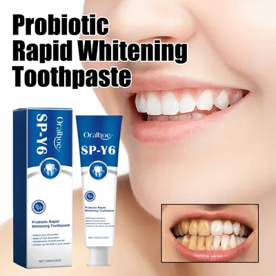 SP-Y6 Maintenance Tooth Enamel Whiten Toothpaste Improving Oral Mint Fresh Breath Remove Stains