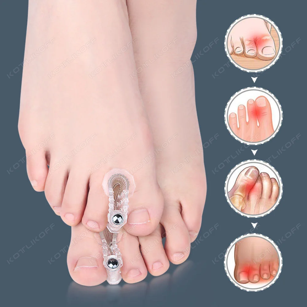 2 stücke Bunion Hallux Valgus Corrector Zehenspreizer Separator Daumen Finger Korrektur Haarglätter Fußpflege Werkzeug Image