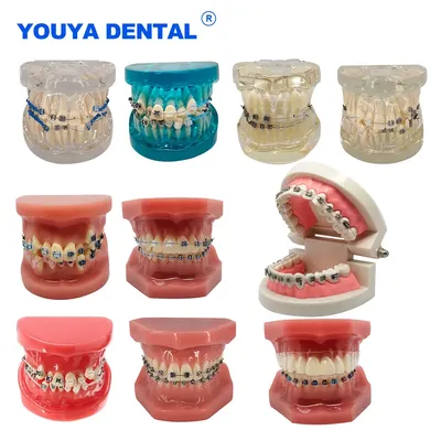 Orthodontic Dental Treatment Teeth Model Teaching Study Gum Tooth Models With Ortho Metal Bracket
