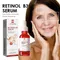 Retinol B3 Face Essence Deep Moisturizing Fade Fine Line Lifting Firming Repair Smooth Nourish Tighten Brighten Serum Skin Care