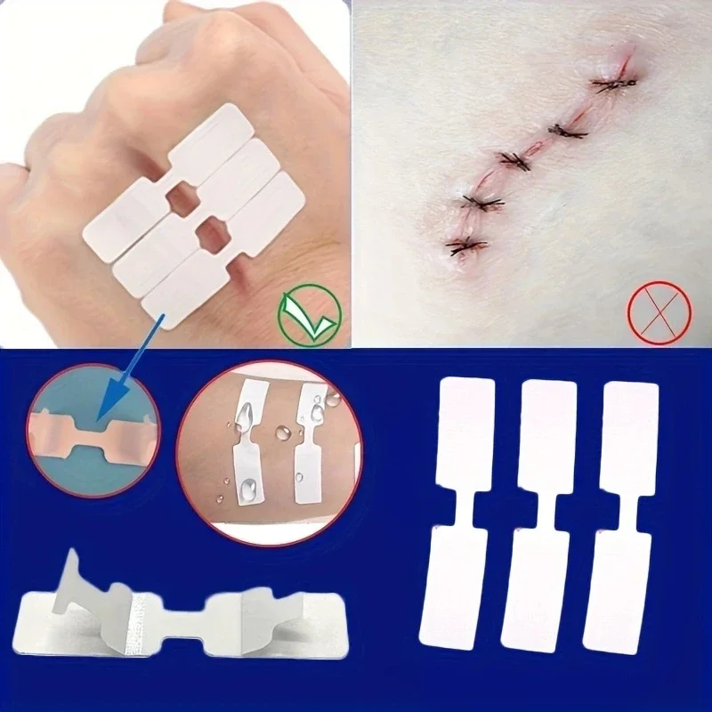 10-50Pcs Outdoor Wunde Klebstoff Einweg Band Erste Hilfe Wunde Naht Patch Wunde Pflaster Notfall Schnelle Naht patch Image