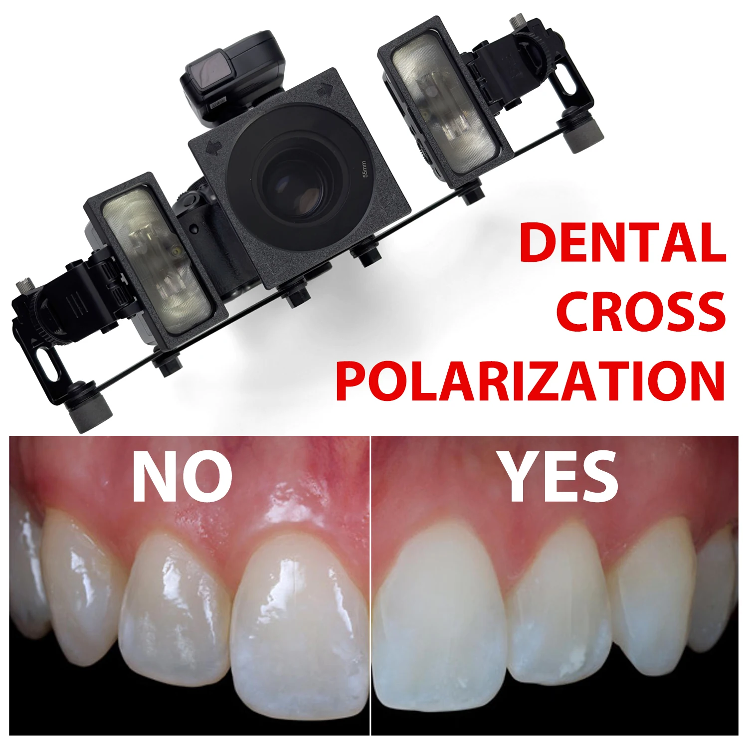 Dental Cross Polarisation Kit für Godox MF12 Kamerablitz – keine Reflexionen, kein Blendung Kamera Foto Kit Polar Eye für Zahnarzt Image