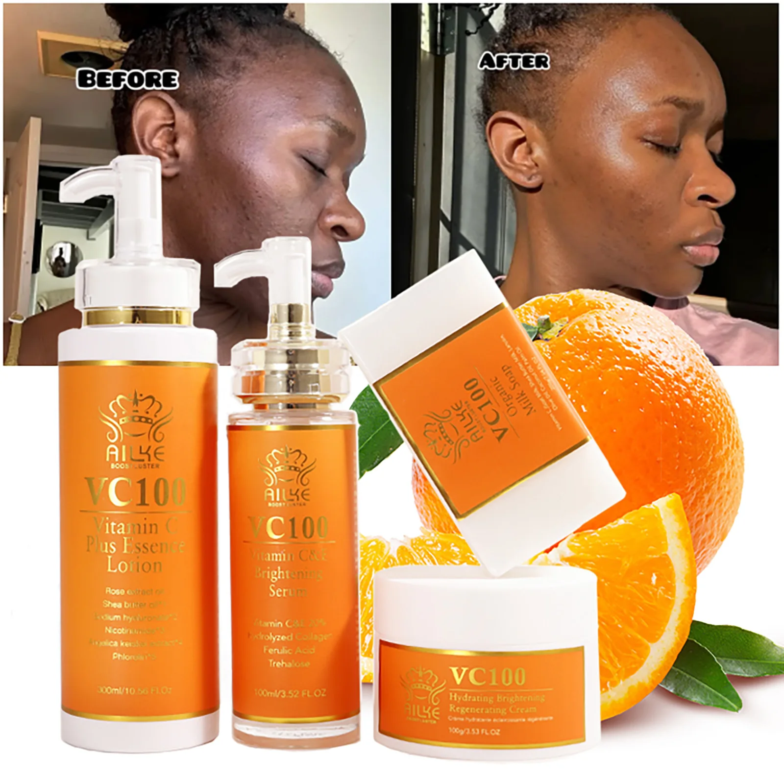 AILKE Vitamin C Whitening 4-in-1-Set, glatte Haut, Falten reduzieren, schwarze Flecken, feuchtigkeitsspendend, mit Kollagen, Vitamin E Image