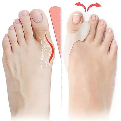 Bunion Cushion Protection (Suitable Night And Home Use And Replace Them Regularly) Toe Corrector Relieving Pressure For Pain Relief