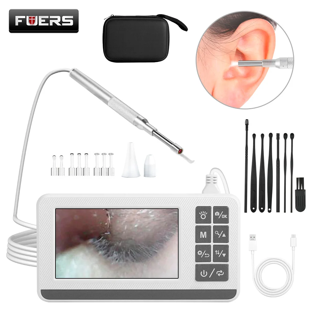 FUERS Ohr-Endoskop-Kamera, 4,3-Zoll-Vollfarb-LCD-Bildschirm, Ohrumfang, Otoskop mit Licht, Ohrkamera mit Werkzeugen zum Entfernen von Ohrenschmalz Image