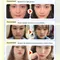 Chin Cheek Slimming Bandage V Shaper V Lifting Anti Mask Face Wrinkle Strap Line Lifting Band Sleeping Mask Beauty Health