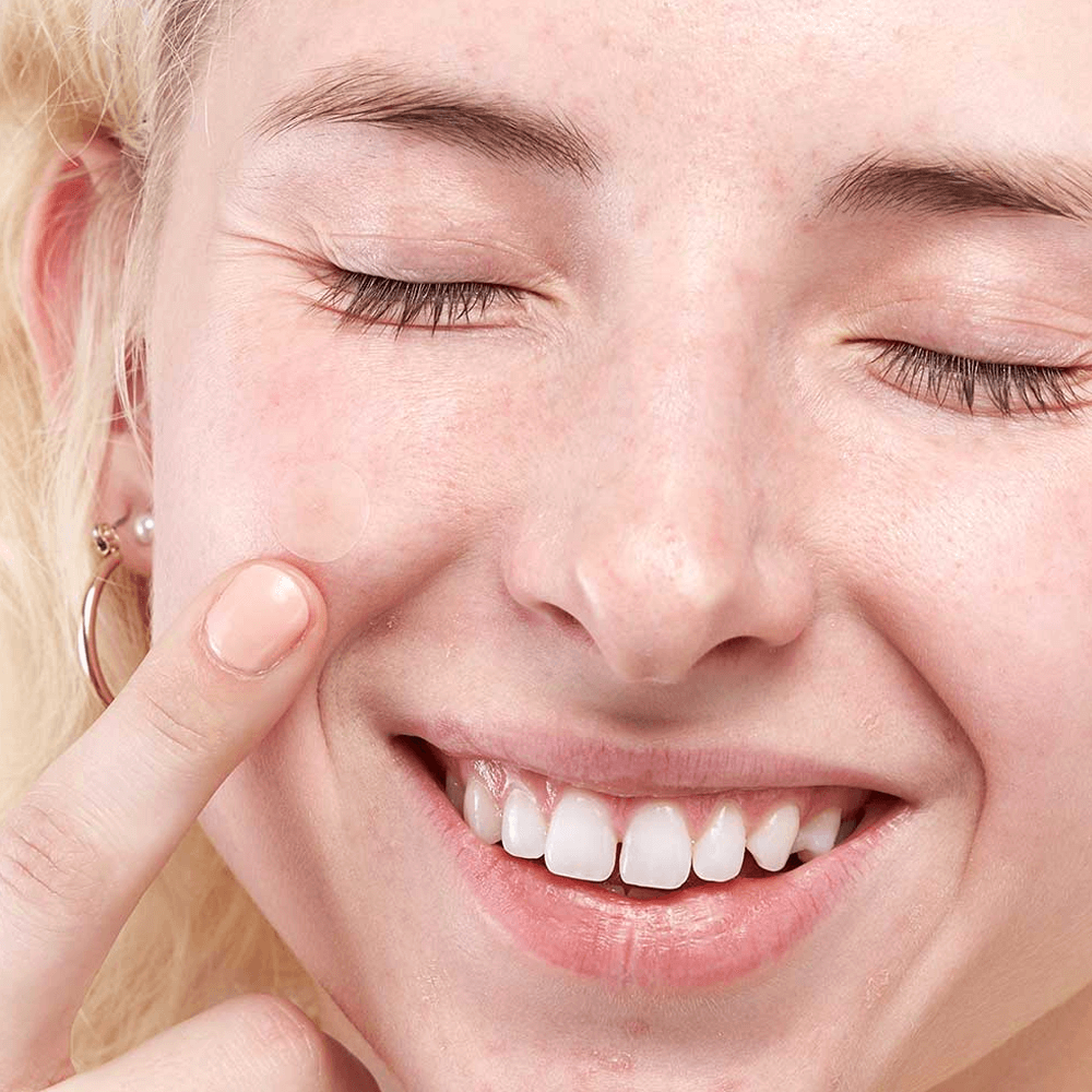 Skin Tag Removal Kit | Small & Standard Skin Tag Remover Device | Painless Skin Tag Remover Skin Tag Removal Kit | Small & Standard Skin Tag Remover Device | Painless Skin Tag Remover