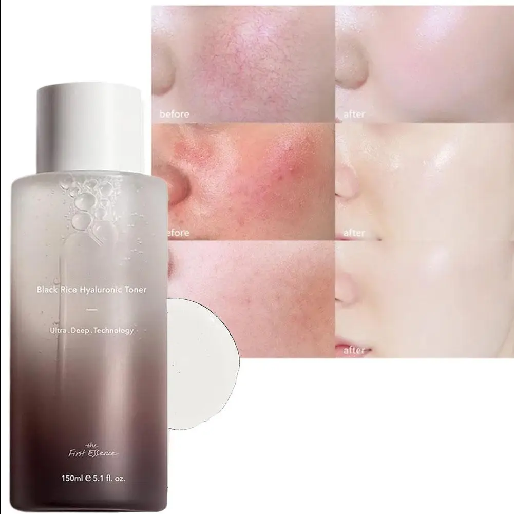 Haruharu Wonder riz noir acide hyaluronique Toner coréen soin du visage ensemble de Toner Toner élimination de l
