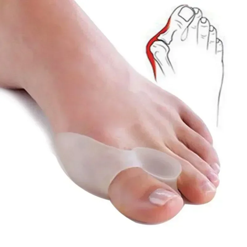 2PCS Silikon Gel Daumen Corrector Bunion Fuß Zehe Hallux Valgus Schutz Separator Finger Haarglätter Teller Fußpflege Werkzeug