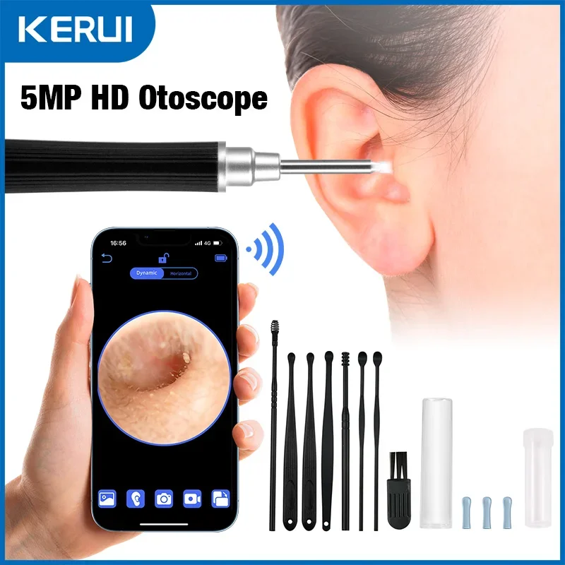 Otoskop zum Entfernen von Ohrenschmalz, 5 MP HD-Ohrreiniger mit 360-Großwinkel-Ohrendoskop, WLAN-Ohrreiniger-Kamera mit 6 LEDs, Ohrpflücker Image