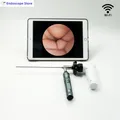 HD 1080P 60FPS Endoscopio portatile WIFI Telecamera wireless ORL Veterinario Animale Ospedale Display per telefono cellulare