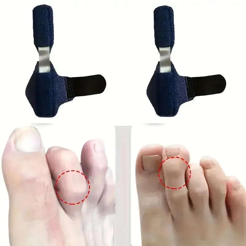 Klaue Zehenstabilisator Stützklammer Zehen 1/2 Stück Schiene Glätteisen für Hammerzehenkorrektur Crooked Wrap Schmerzlinderung Kinder Erwachsene Image