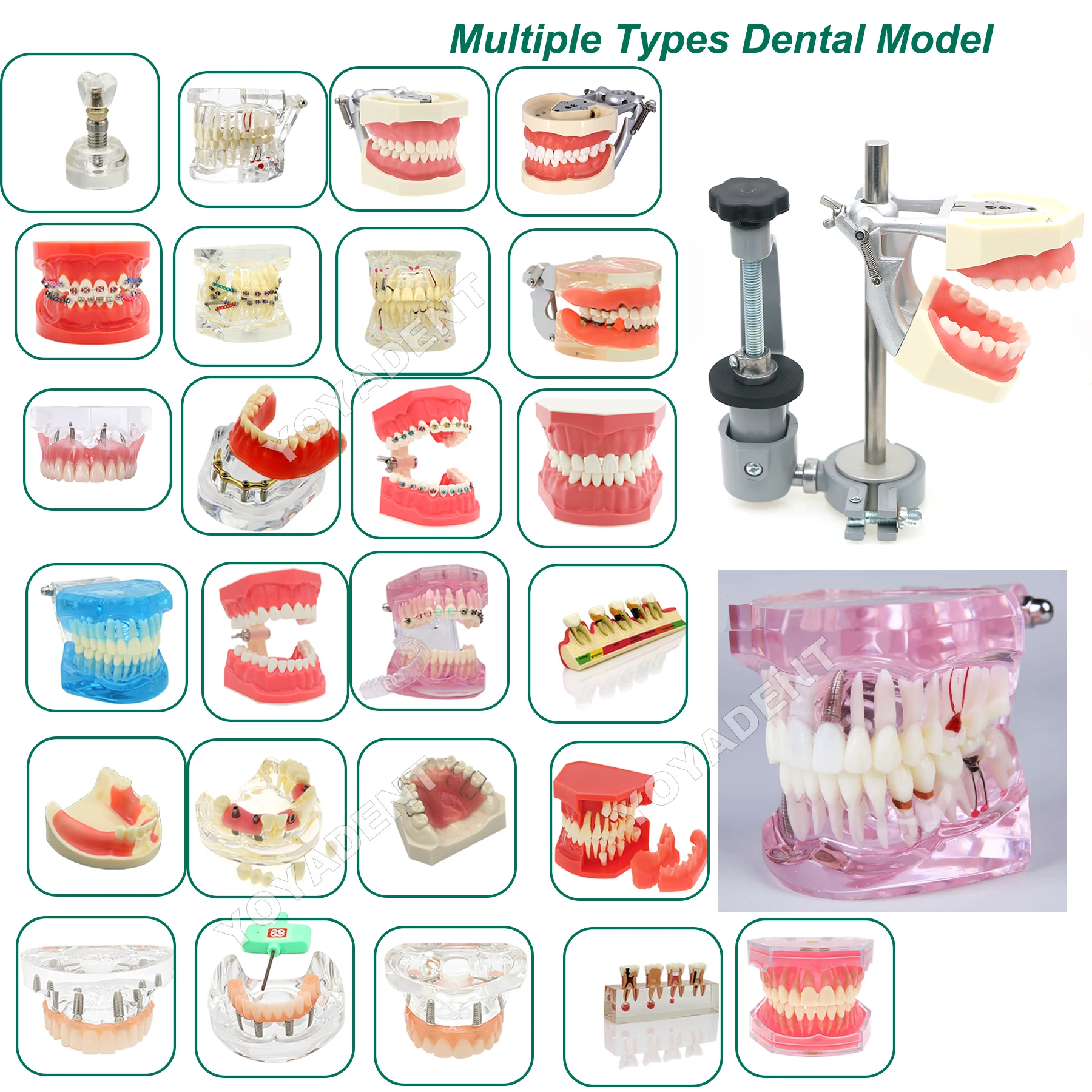 Dental Modell Studie Kieferorthopädische Abnehmbare Zähne Implantat Modell Zahnarzt Lehrmaterial Image
