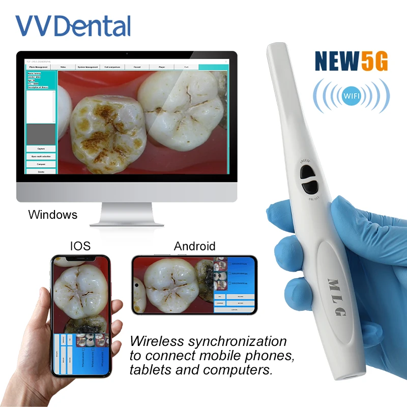VVDental Kabelloser Oraler Viewer Intraorale Kamera 1080p HD Intraorale Kamera zur Beobachtung von Zahnkaries Image