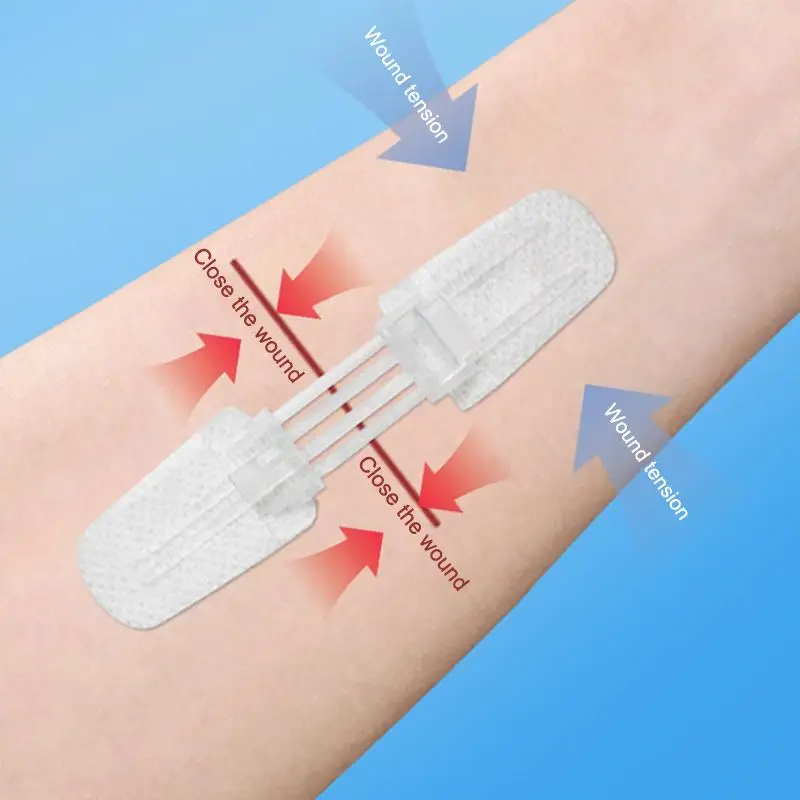 Schmerzfreier Wundverband mit Reißverschluss für Outdoor-Erste-Hilfe-Pflaster Image